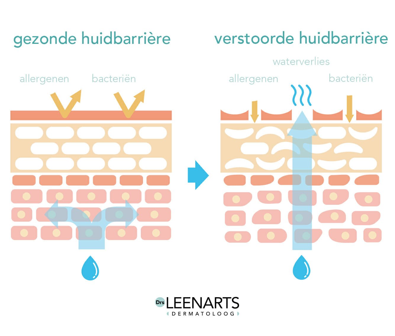 niacinamide versterkt huidbarriere