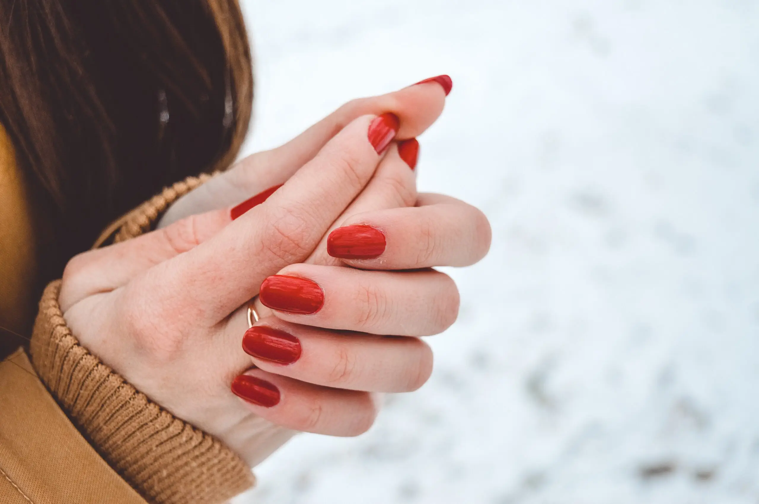 Trockene Hände im Winter. Drs Leenarts bietet die Lösung.